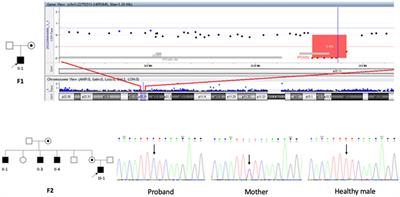PTCHD1 gene mutation/deletion: the cognitive-behavioral phenotyping of four case reports